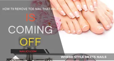 Toe Nail Removal: What to Do When It's Half Off