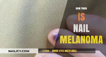 Understanding Nail Melanoma: Thickness, Detection, and Early Warning Signs