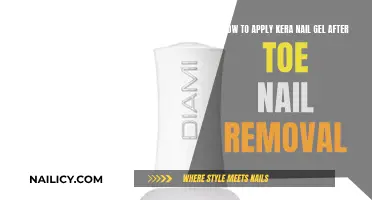 Kera Nail Gel: Post-Toe Nail Removal Application Guide
