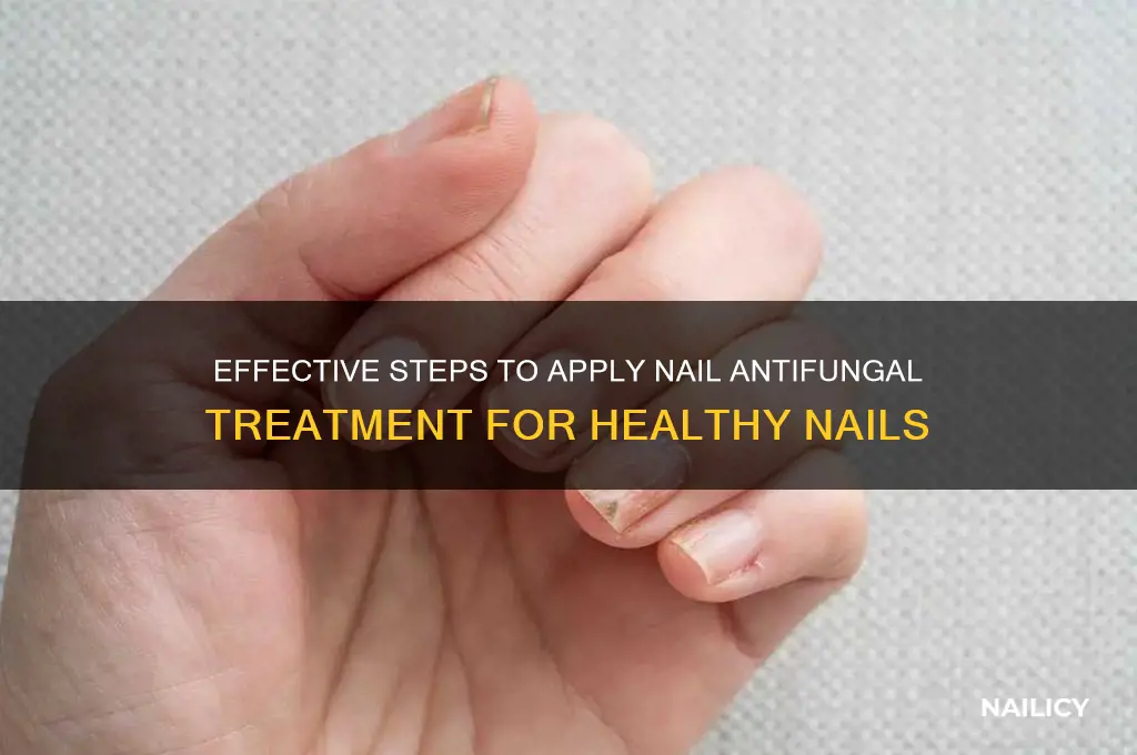 how to apply nail antifungal