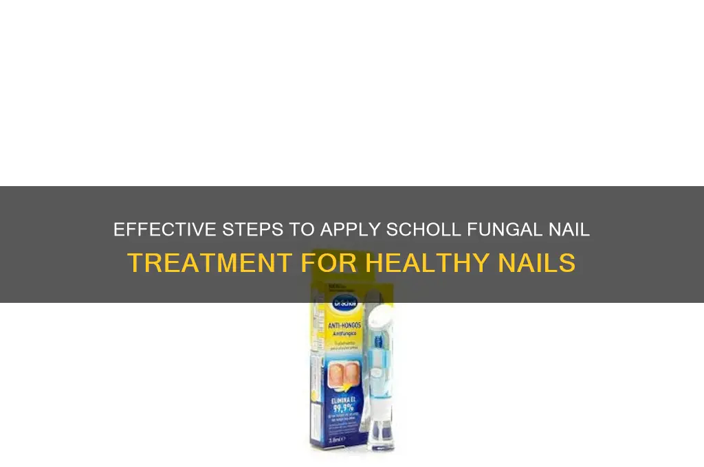 how to apply scholl fungal nail treatment