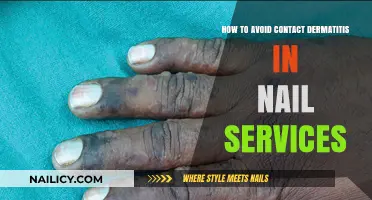 Prevent Contact Dermatitis: Safe Nail Care Tips for Healthy Skin