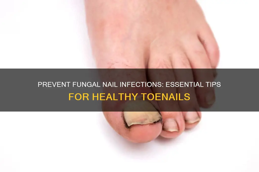 how to avoid fungal nail