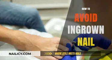 Prevent Painful Ingrown Nails: Simple Tips for Healthy Toenails