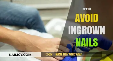 Prevent Ingrown Nails: Simple Tips for Healthy, Pain-Free Toenails