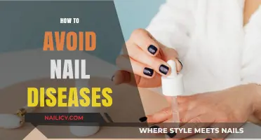 Prevent Nail Diseases: Essential Tips for Healthy, Strong Nails