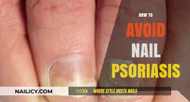 Effective Tips to Prevent and Manage Nail Psoriasis Flare-Ups