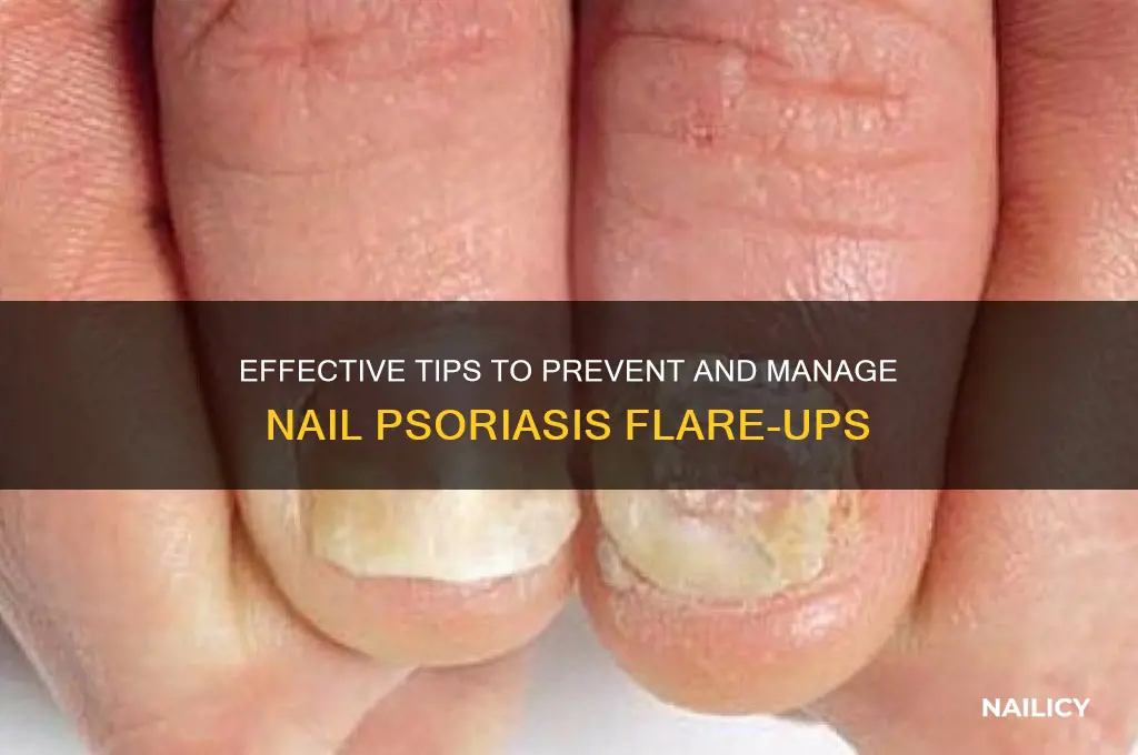 how to avoid nail psoriasis