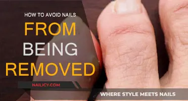Keep Your Nails Intact: Tips to Avoid Nail Removal