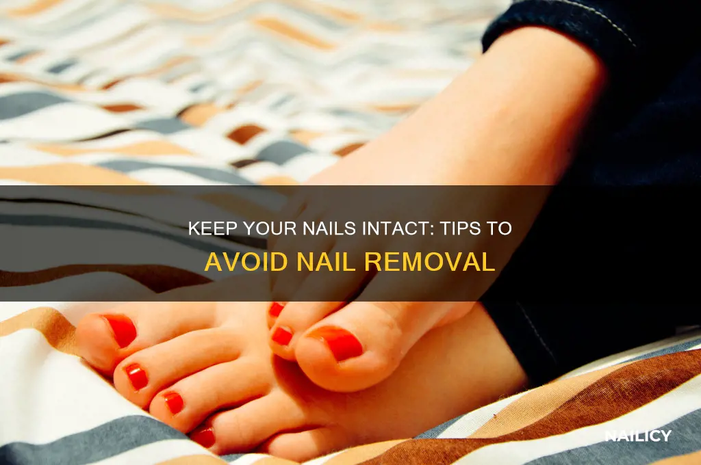 how to avoid nails from being removed