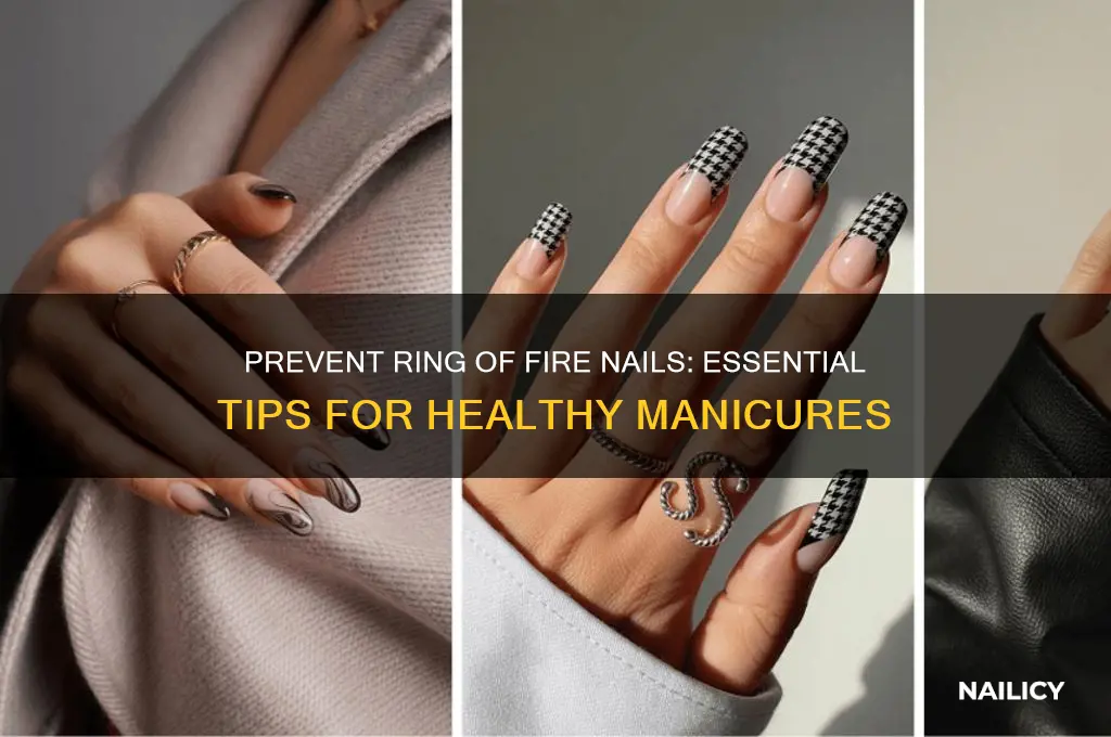 how to avoid ring of fire nails