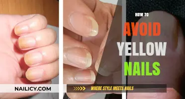 Prevent Yellow Nails: Simple Tips for Healthy, Bright Manicures