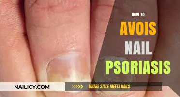 Effective Strategies to Prevent and Manage Nail Psoriasis Flare-Ups
