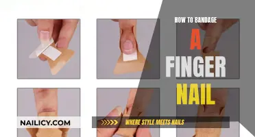 Bandaging a Finger Nail: Quick and Easy Steps to Follow