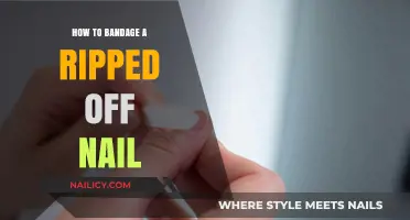 Emergency Nail Care: How to Bandage a Ripped-Off Nail Safely