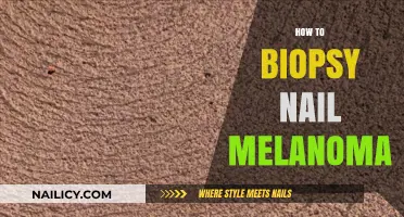 Diagnosing Nail Melanoma: A Step-by-Step Guide to Biopsy Procedures