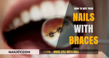 Biting Nails with Braces: Tips for a Safe and Comfortable Habit