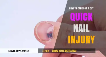 Quick Nail Cuts: Treating and Avoiding Infections