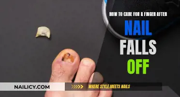 Caring for a Finger After Nail Loss