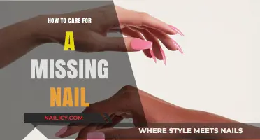 Caring for a Missing Nail: Gentle Healing Tips and Tricks