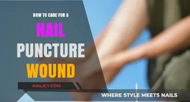 Effective Care Tips for Treating and Healing Nail Puncture Wounds