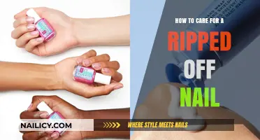 Quick Relief: Caring for a Ripped-Off Nail at Home