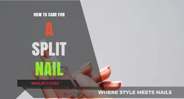 Quick Fixes and Tips for Healing a Split Nail