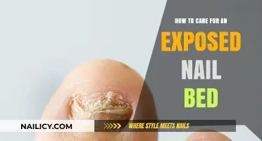 Healing Exposed Nail Beds: Essential Care Tips for Quick Recovery