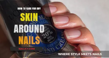 Nourish and Protect: Effective Tips for Dry Skin Around Nails