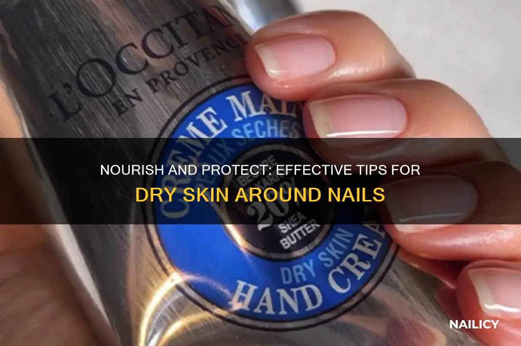 how to care for dry skin around nails