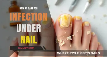 Effective Tips for Treating and Preventing Infections Under Your Nails