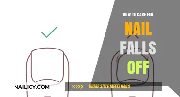 Nail Falls Off? Here’s How to Care and Heal Properly