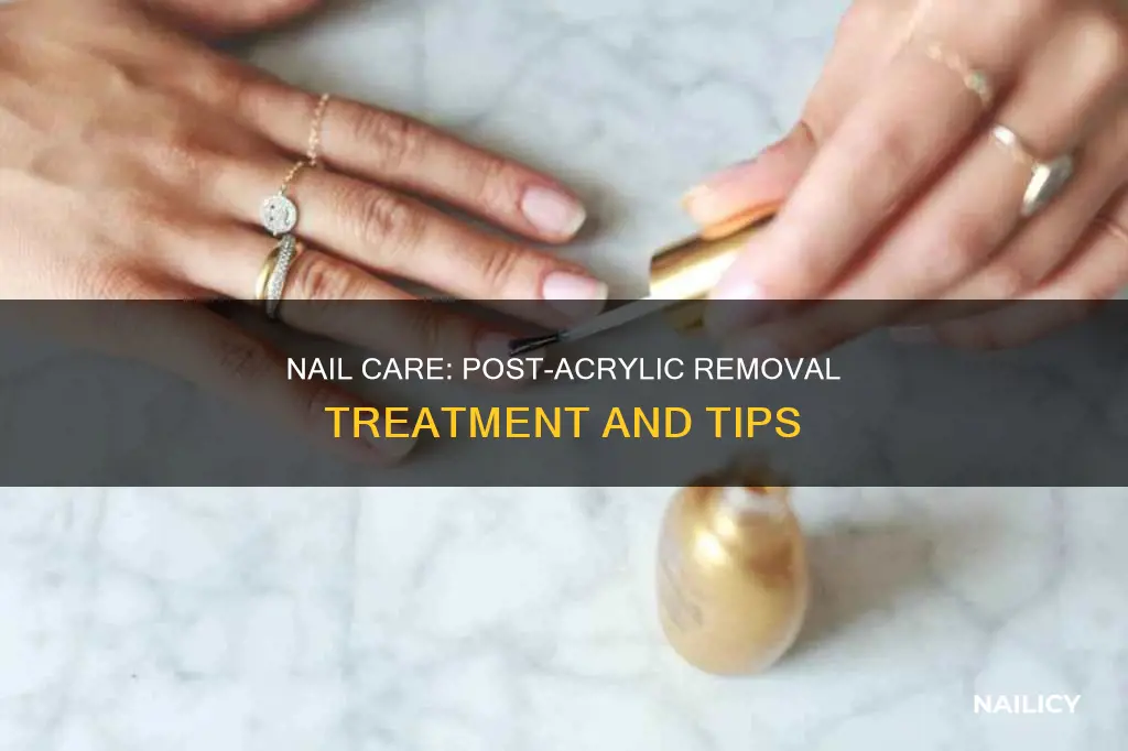 how to care for nails after acrylic removal