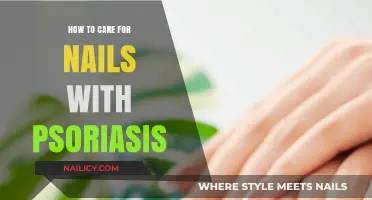 Nurturing Nails with Psoriasis: Gentle Care Tips for Healthy Hands
