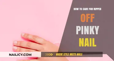 Quick Tips for Healing and Caring for a Ripped Pinky Nail