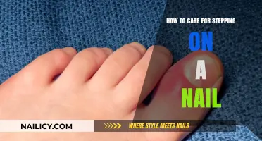 Stepping on a Nail? Essential First Aid and Care Tips