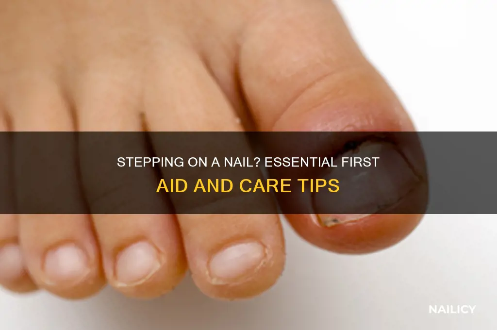 how to care for stepping on a nail