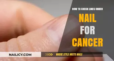 Detecting Skin Cancer: Checking Nail Lines for Early Warning Signs