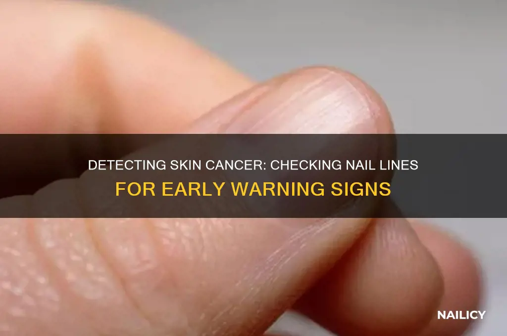 how to check lines under nail for cancer