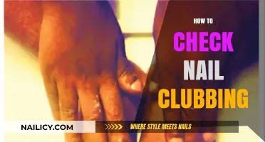 Identifying Nail Clubbing: A Step-by-Step Guide to Detection and Diagnosis