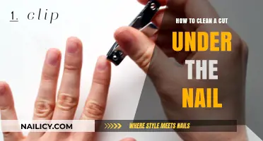 Treating Cuts Under Nails: A Step-by-Step Guide