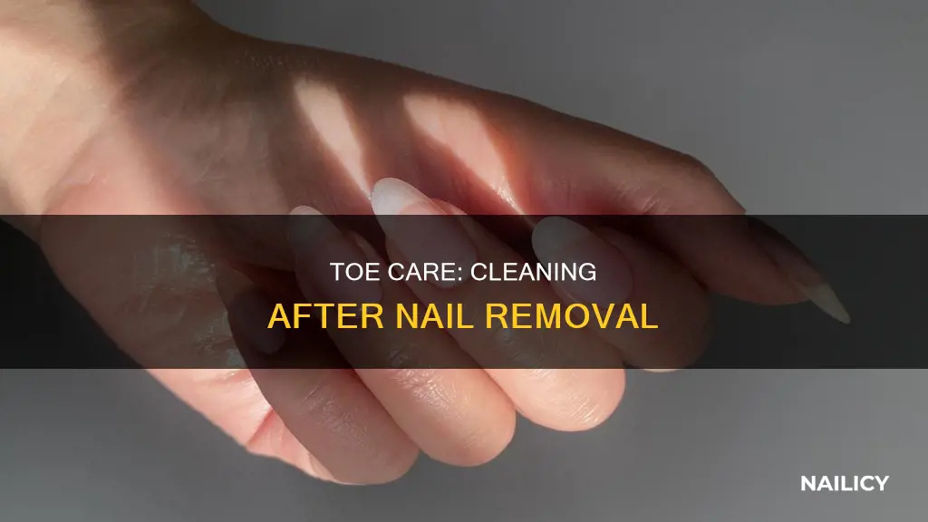 how to clean a toe after nail removal