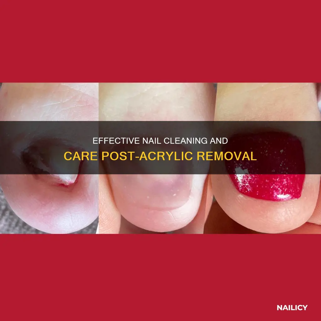 how to clean my nails after removing acrylics
