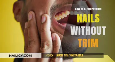 Easy Nail Cleaning for Patients: No Trimming Needed