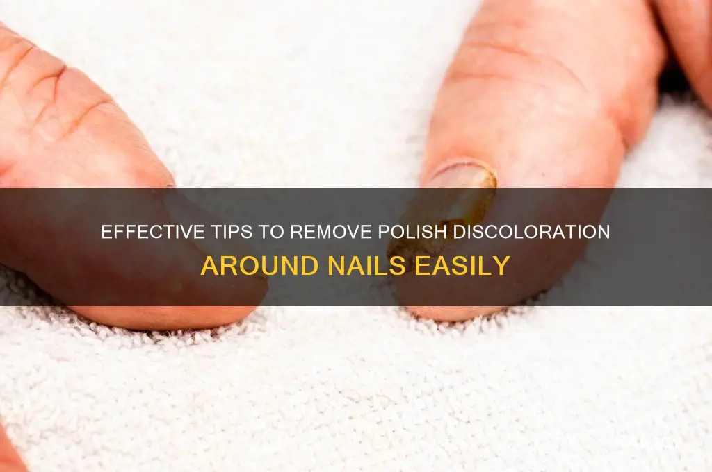 how to clean polish discoloration around nails