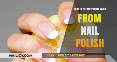 Restore Nail Health: Effective Tips to Clean Yellow Nails from Polish