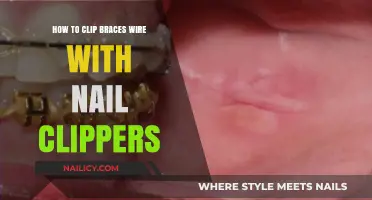 Quick Fix: Safely Clipping Braces Wire with Nail Clippers Guide