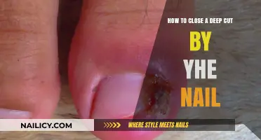 Healing Deep Nail-Bed Cuts: Quick Steps to Take