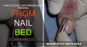Foreign Body Removal: Coding for Nail Bed Procedures