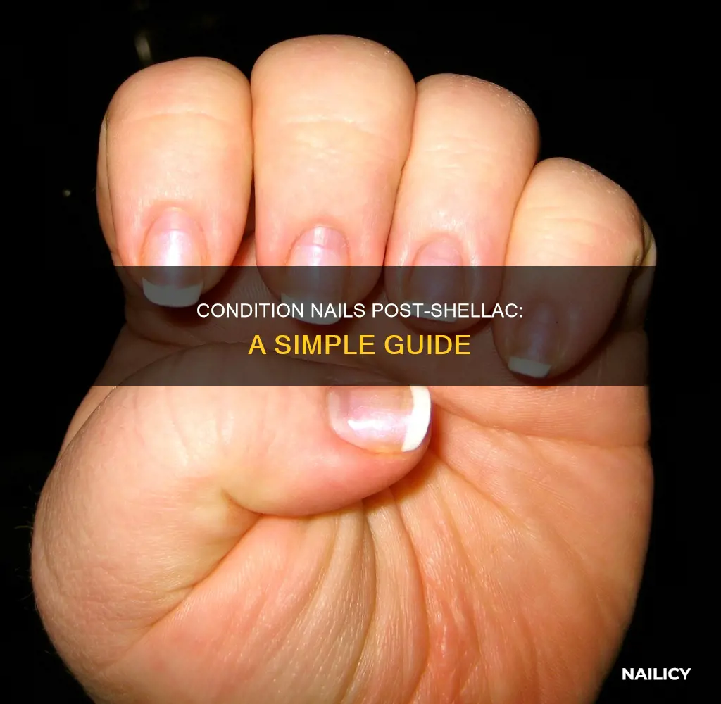 how to condition nails after shellace is removed